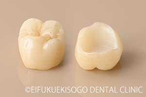 オールセラミッククラウン