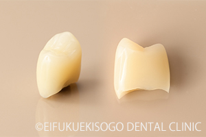 オールセラミッククラウン
