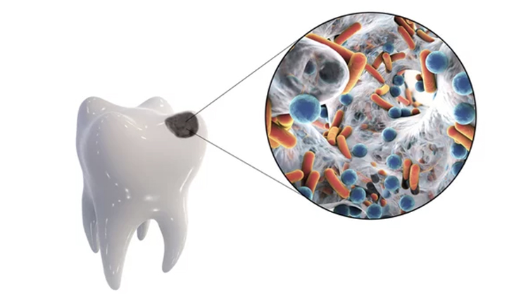 ミュータンス菌