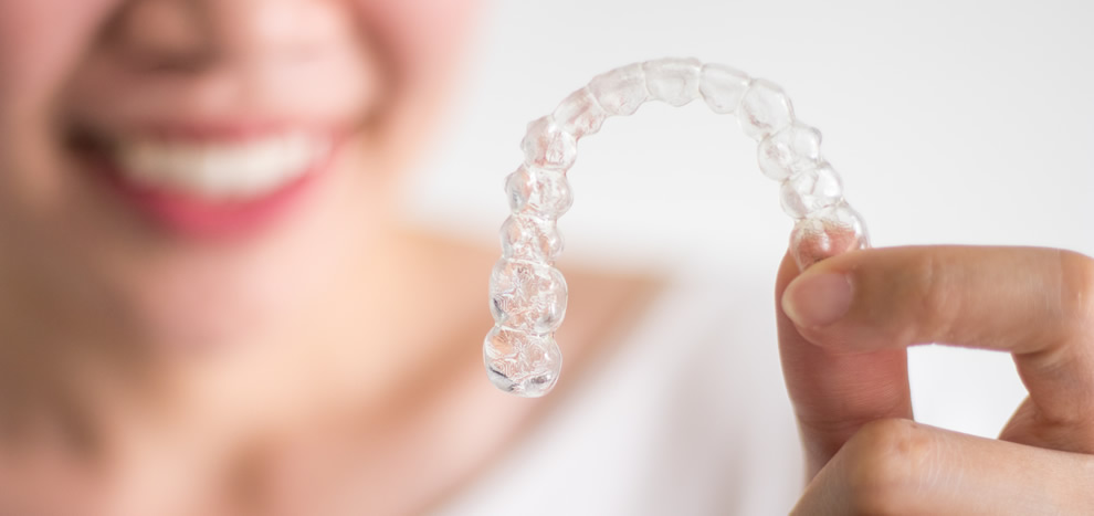 マウスピース矯正