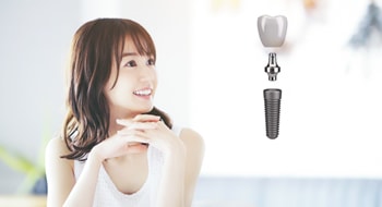 豊富なインプラント実績